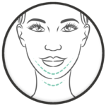Dokter Wever - facelift en halslift