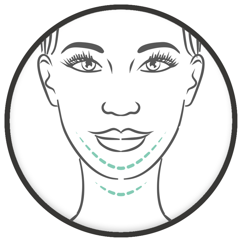 Dokter Wever - facelift en halslift
